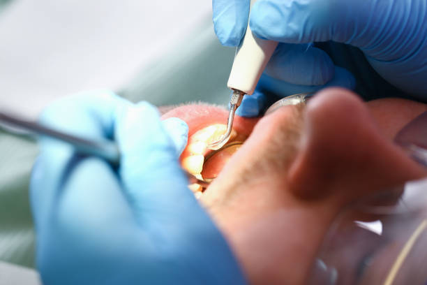 Best Teeth Whitening  in Logansport, LA